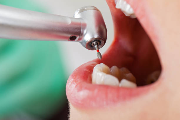 Best Emergency Dental Surgery in Teaticket, MA